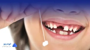 تحقیق در مورد دندان های شیری و دائمی ❤ دانلود PDF