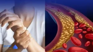 تحقیق در مورد دیابت پر خطر چه علائمی دارد؟  ❤ دانلود PDF